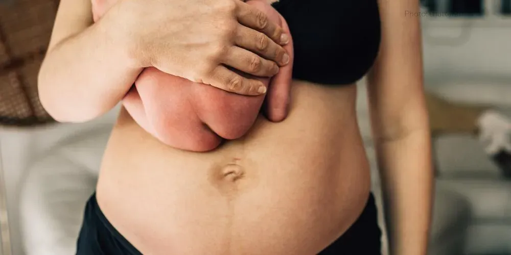 Losing your baby bump after baby’s birth