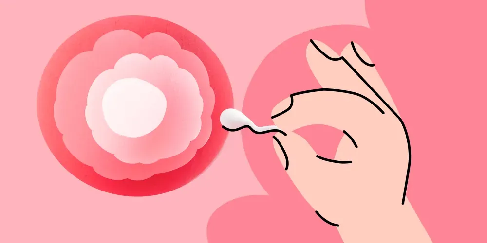 7 myths about IVF