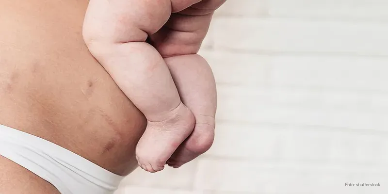 La vida después del parto: ¿cómo aceptar tu nuevo cuerpo?